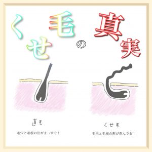 くせ毛 原因