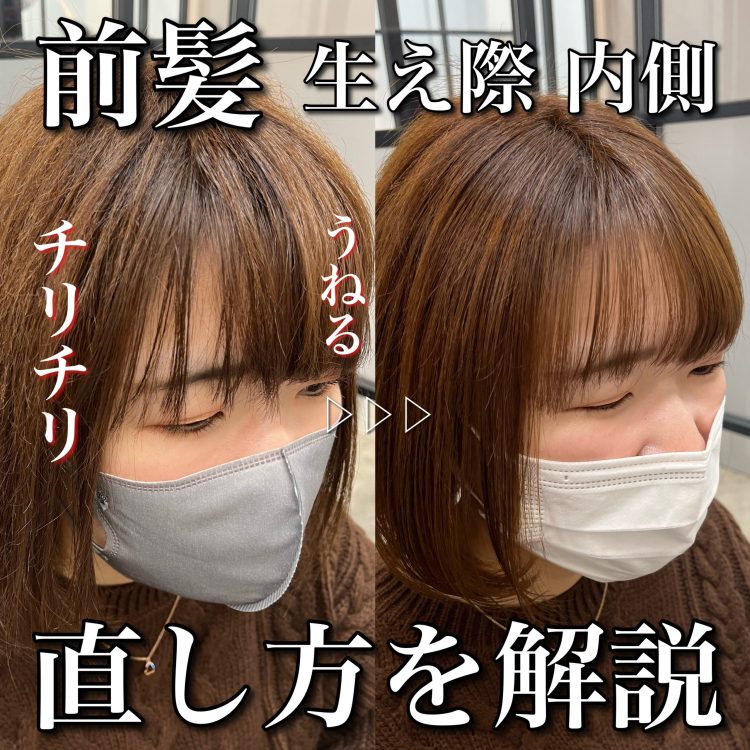 前髪の生え際がチリチリになる原因とは 間違った対処法と直し方を美容師が解説 パーマ美容師 森越こだわりのパーマを紹介